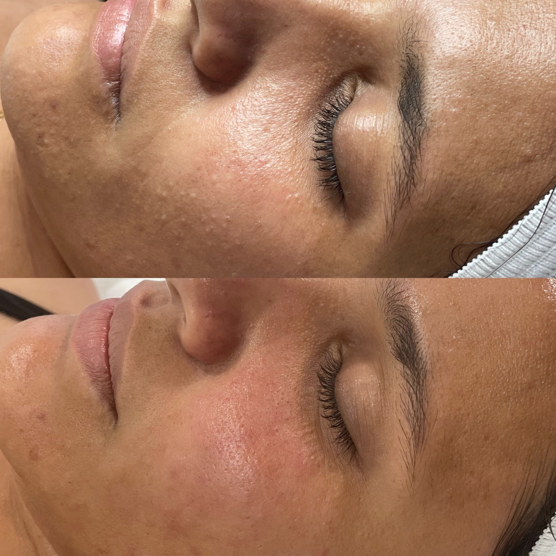 Before and after treatment result 2