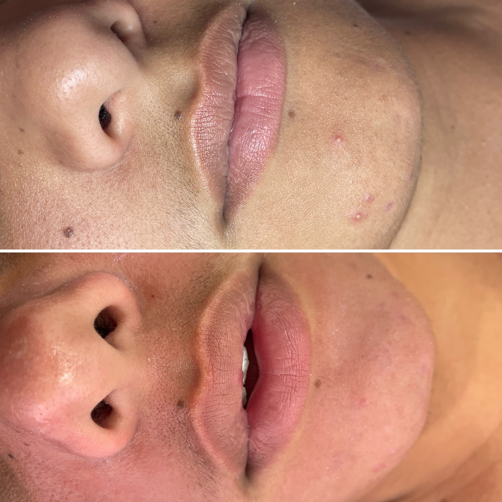 Before and after treatment result 3