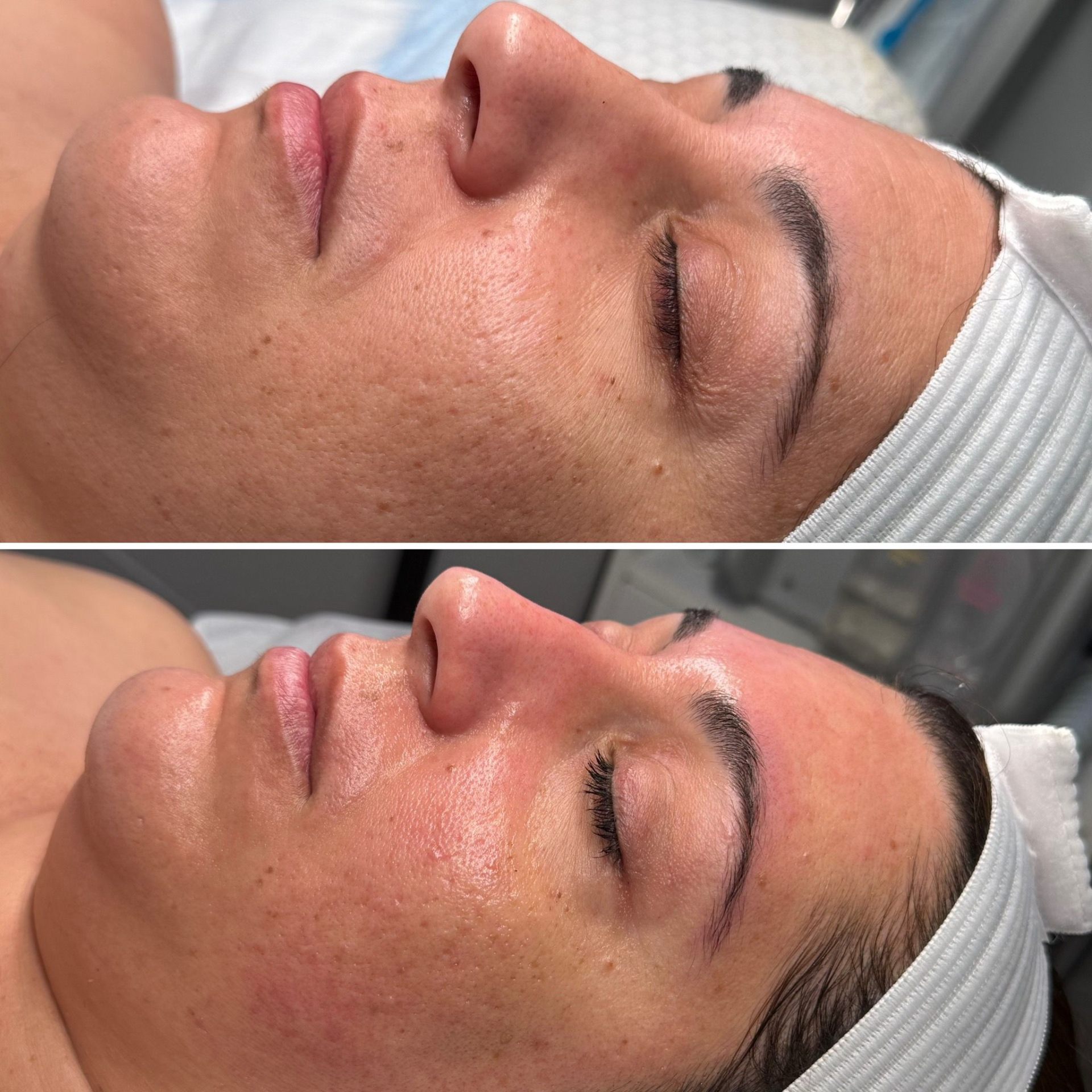 Before and after treatment result 6