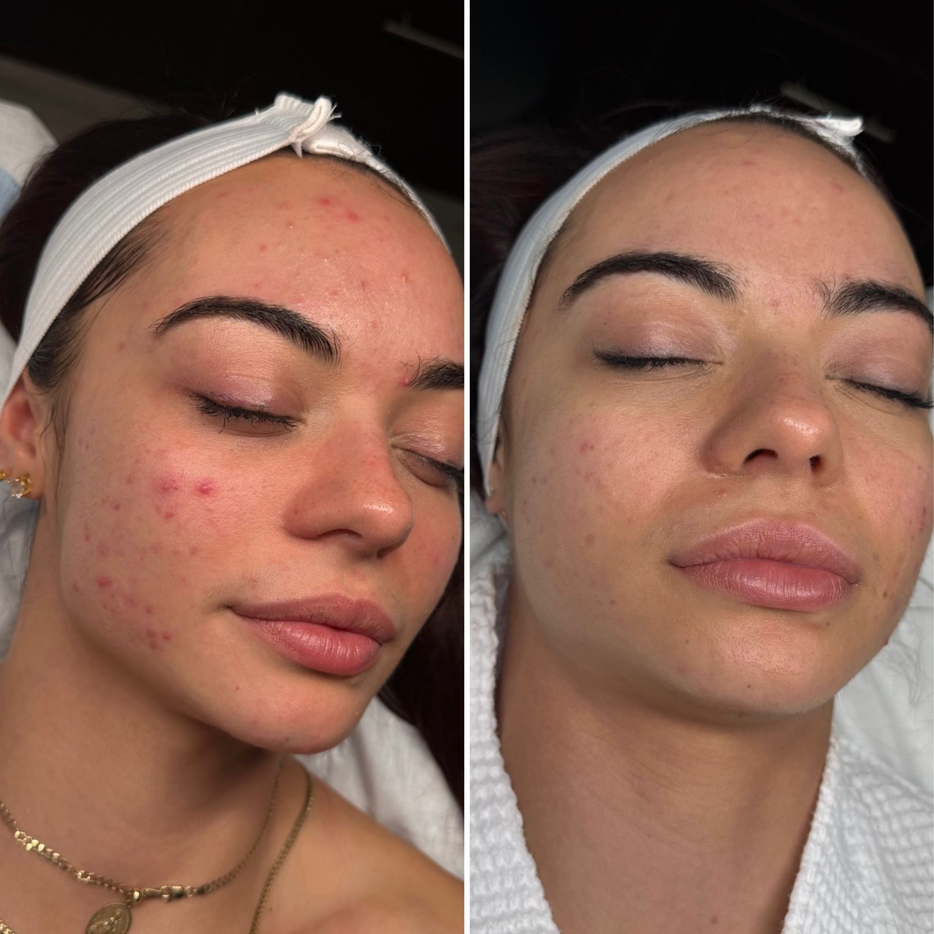 Before and after treatment result 7