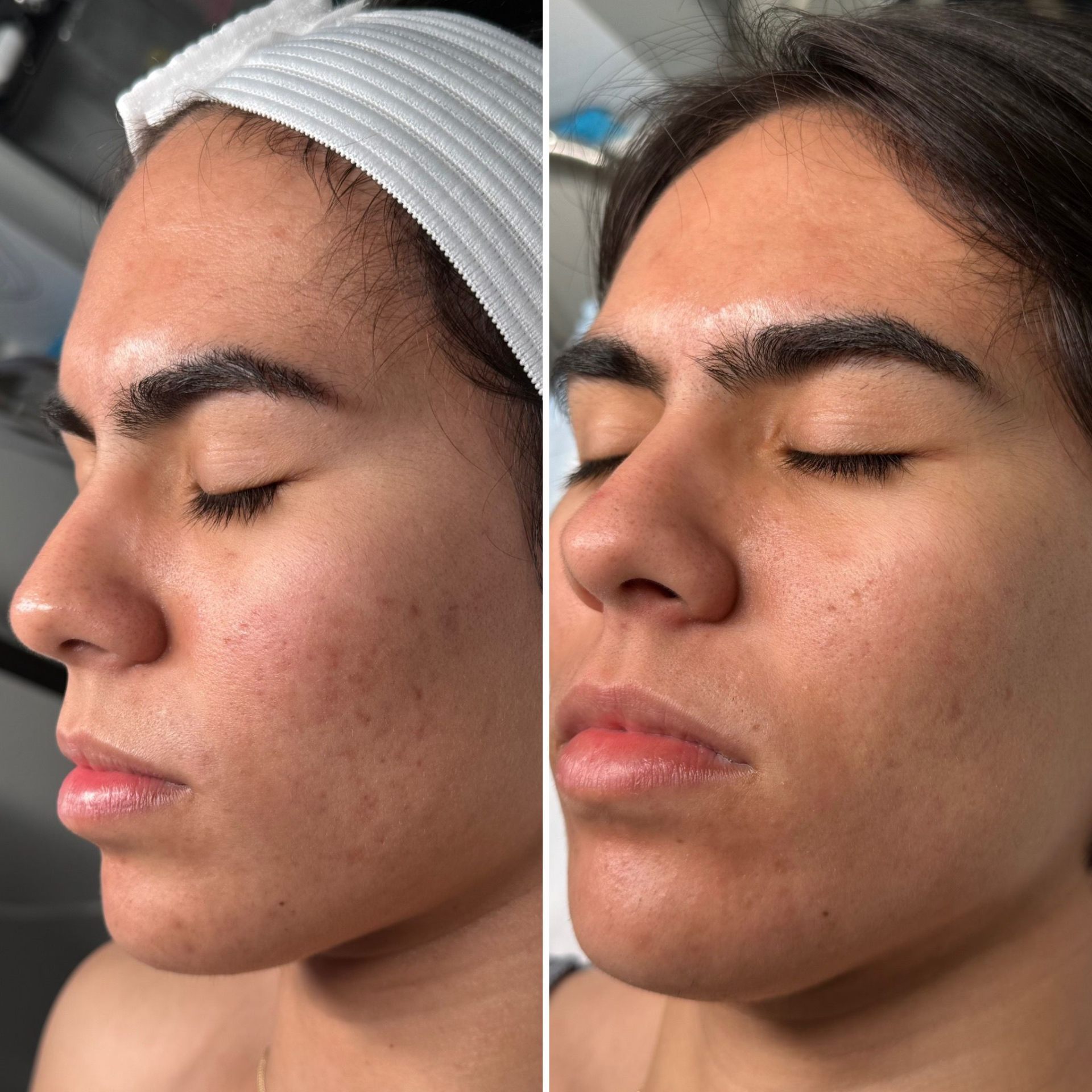 Before and after treatment result 8