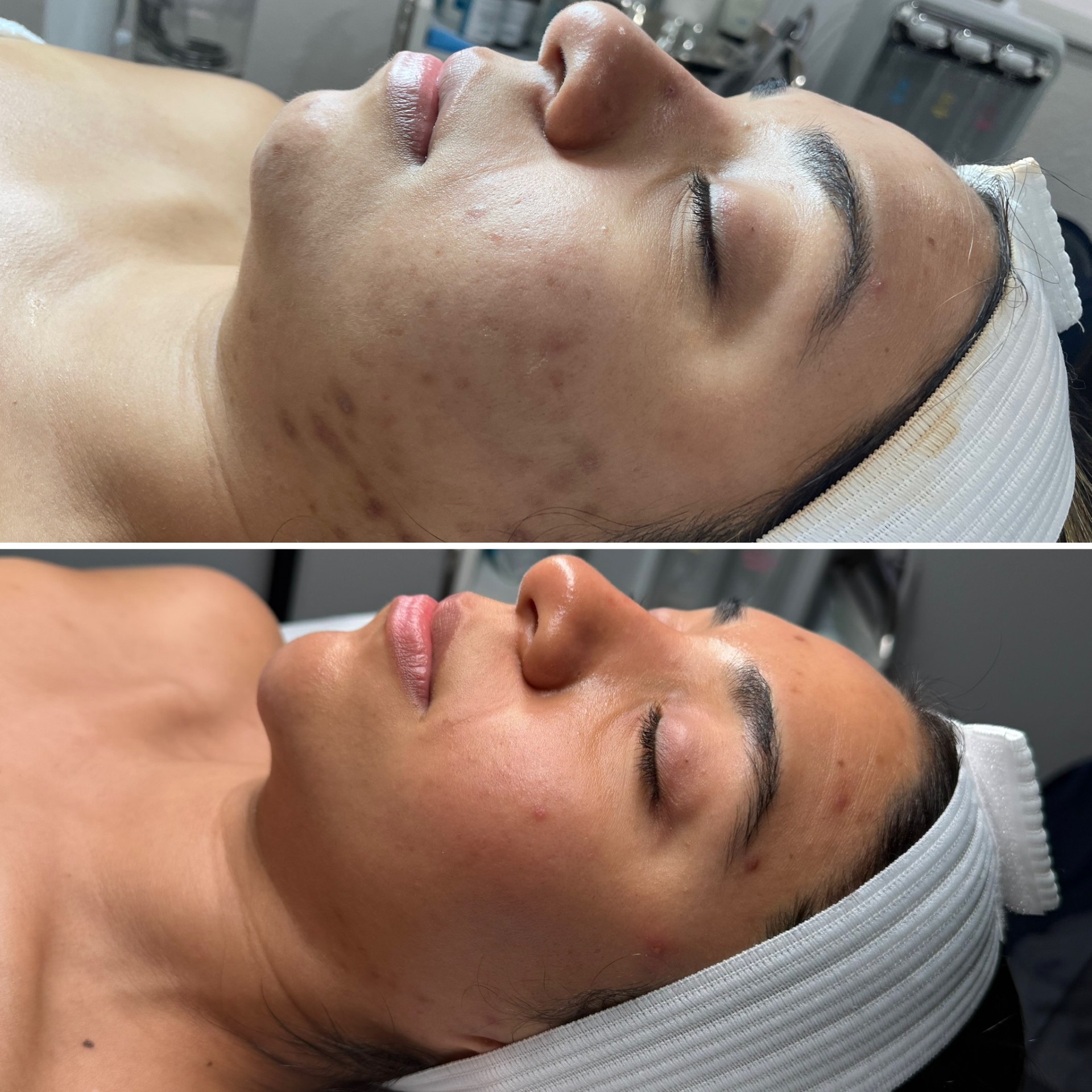 Before and after treatment result 9